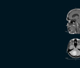 Biomedical imaging of the skull